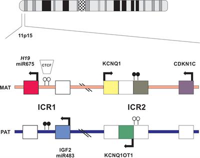 Adrenocortical Tumors in Children With Constitutive Chromosome 11p15 Paternal Uniparental Disomy: Implications for Diagnosis and Treatment